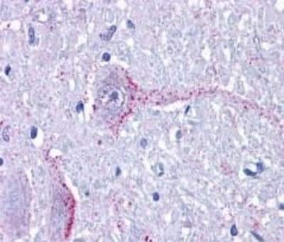 Immunohistochemistry: GPR6 Antibody [NBP3-14361]